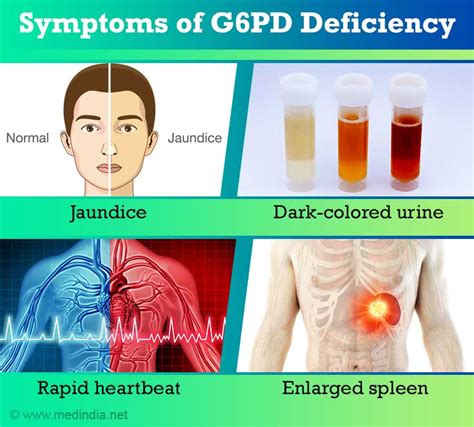 sintomas ng g6pd tagalog|A Guide to G6PD Deficiency .